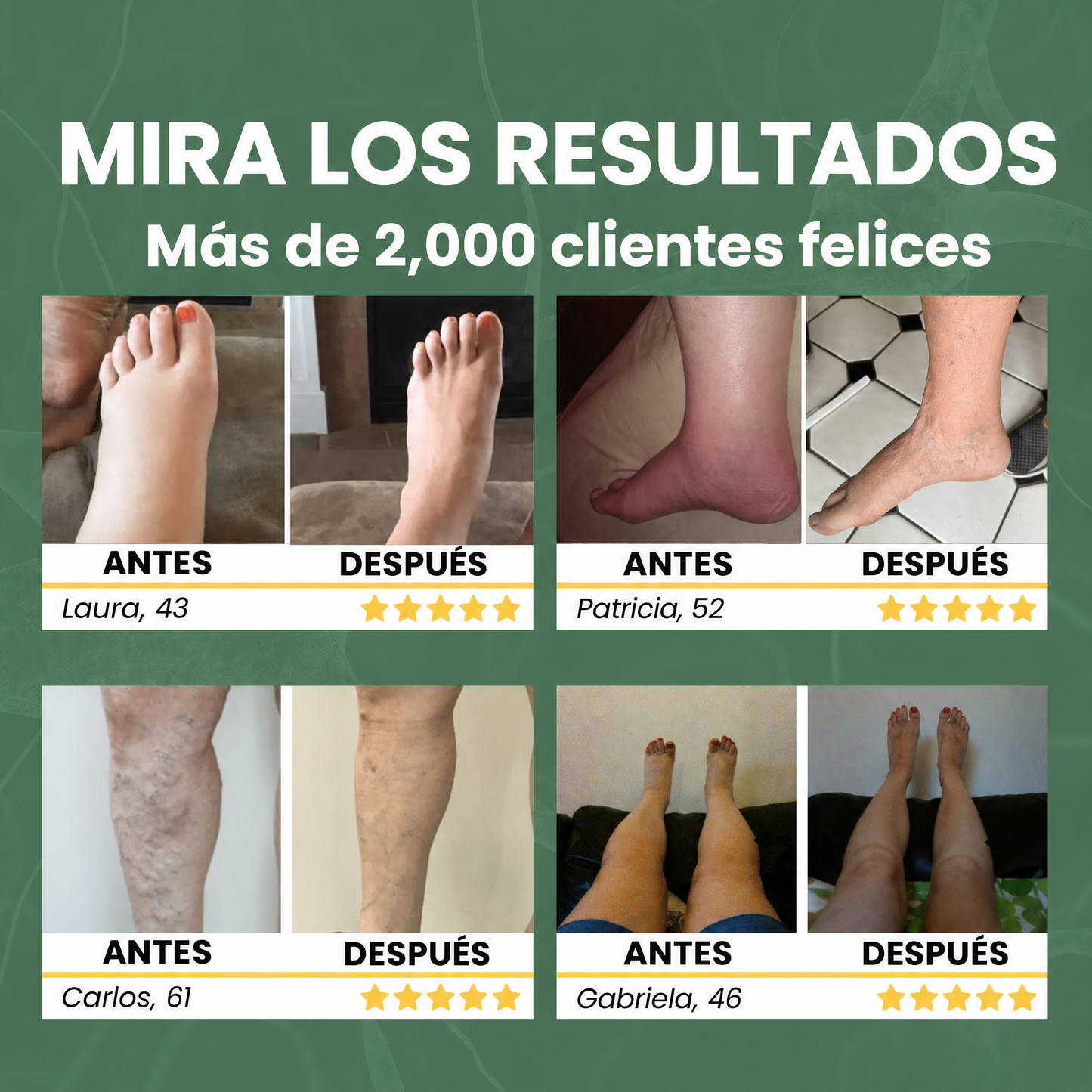 OmniVida Balsamo Miracolo™ – Balsamo per Gambe Gonfie e Pesanti